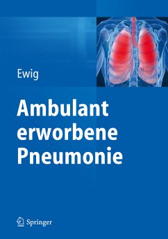 Ambulant erworbene Pneumonie (eBook, PDF)