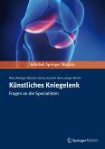 Künstliches Kniegelenk (eBook, PDF)