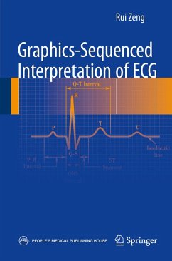 Graphics-sequenced interpretation of ECG (eBook, PDF)