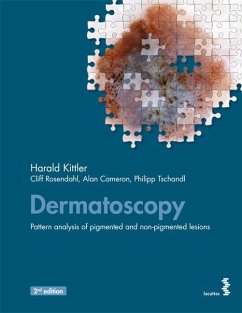 Dermatoscopy - Kittler, Harald;Rosendahl, Cliff;Cameron, Alan