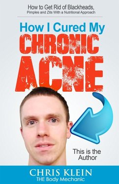 How I Cured My Chronic Acne: How to Get Rid of Blackheads, Pimples and Zits With a Nutritional Approach (eBook, ePUB) - Klein, Chris