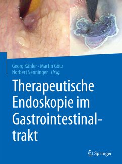 Therapeutische Endoskopie im Gastrointestinaltrakt (eBook, PDF)