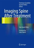 Imaging Spine After Treatment (eBook, PDF)