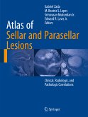 Atlas of Sellar and Parasellar Lesions (eBook, PDF)
