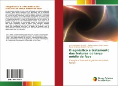 Diagnóstico e tratamento das fraturas do terço médio da face - Slusarenko da Silva, Yuri;Zindel Deboni, Maria Cristina;Naclério-Homem, Maria da Graça