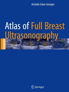 Atlas of Full Breast Ultrasonography - Georgescu, Aristida