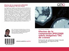 Efectos de la compresión JPEG2000 sobre imágenes TAC de cráneo - Miranda Castañeda, Iroel