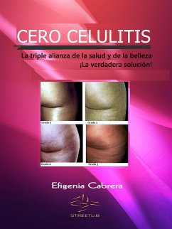 Cero celulitis (fixed-layout eBook, ePUB) - Cabrera, Efigenia