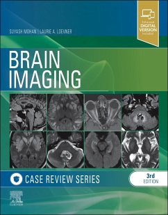 Brain Imaging: Case Review Series - Mohan, Suyash; Loevner, Laurie A.