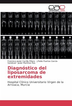 Diagnóstico del liposarcoma de extremidades