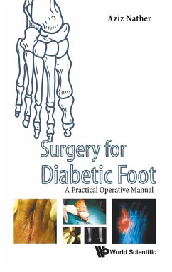 SURGERY FOR DIABETIC FOOT - Aziz Nather