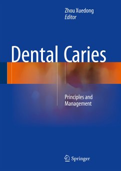 Dental Caries (eBook, PDF)