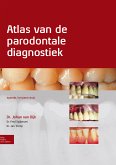 Atlas van de parodontale diagnostiek (eBook, PDF)