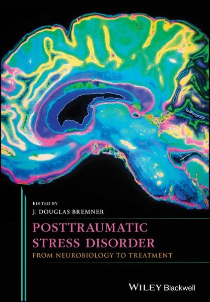 Posttraumatic Stress Disorder (eBook, ePUB)