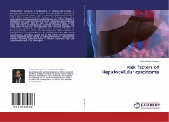 Risk factors of Hepatocellular carcinoma