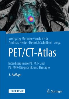 PET/CT-Atlas