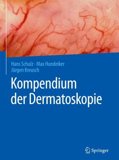 Kompendium der Dermatoskopie - Schulz, Hans;Hundeiker, Max;Kreusch, Jürgen