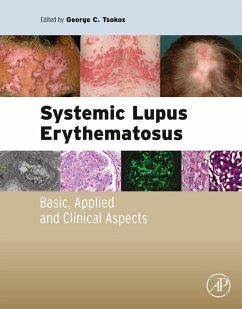 Cover Systemic Lupus Erythematosus (eBook, ePUB)