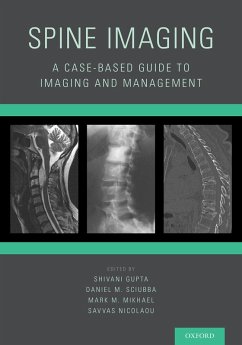 Spine Imaging (eBook, PDF)