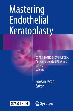 Mastering Endothelial Keratoplasty