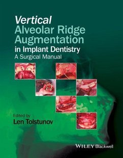 Vertical Alveolar Ridge Augmentation in Implant Dentistry (eBook, PDF)