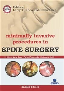 Minimally Invasive Procedures in Spine Surgery (eBook, ePUB) - Özer, Fahir