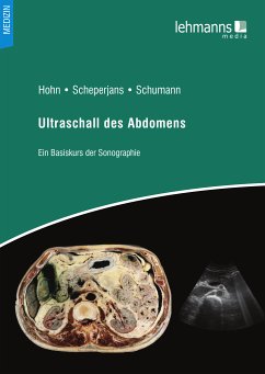 Ultraschall des Abdomens (eBook, PDF)