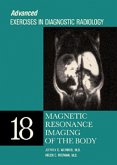 Magnetic Resonance Imaging of the Body (eBook, ePUB)