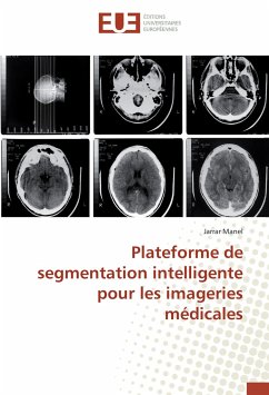 Plateforme de segmentation intelligente pour les imageries médicales - Manel, Jarrar