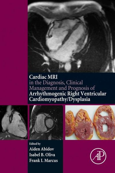 Cardiac MRI in Diagnosis, Clinical Management, and Prognosis of Arrhythmogenic Right Ventricular Cardiomyopathy/Dysplasia (eBook, ePUB)