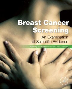 Breast Cancer Screening (eBook, ePUB) - Houssami, Nehmat; Miglioretti, Diana