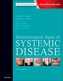 Dermatological Signs of Systemic Disease E-Book (eBook, ePUB) - Callen, Jeffrey P.; Jorizzo, Joseph L.; Zone, John J.; Piette, Warren; Rosenbach, Misha A.; Vleugels, Ruth Ann