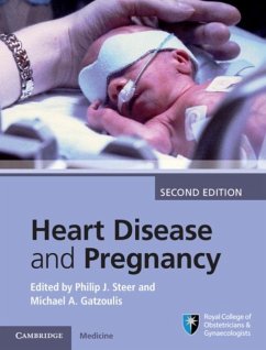 Heart Disease and Pregnancy (eBook, PDF)