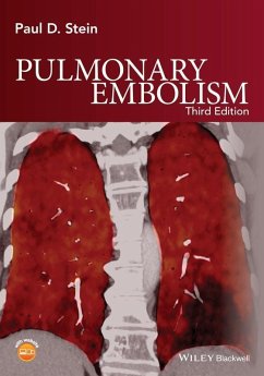 Pulmonary Embolism (eBook, ePUB) - Stein, Paul D.