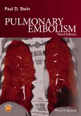 Pulmonary Embolism (eBook, PDF)