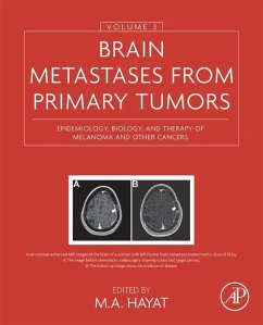 Brain Metastases from Primary Tumors, Volume 3 (eBook, ePUB)