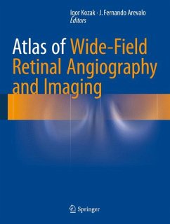 Atlas of Wide-Field Retinal Angiography and Imaging (eBook, PDF)