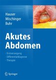 Akutes Abdomen (eBook, PDF)