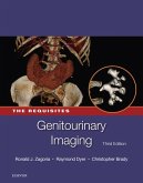 Genitourinary Imaging: The Requisites E-Book (eBook, ePUB) Genitourinary Imaging: The Requisites E-Book (eBook, ePUB)