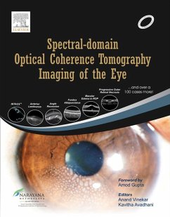 Cover Spectral-domain Optical Coherence Tomography Imaging of the Eye (eBook, ePUB)