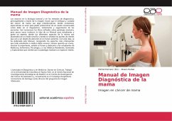 Manual de Imagen Diagnóstica de la mama