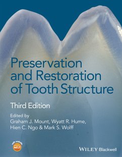 Preservation and Restoration of Tooth Structure (eBook, ePUB)