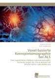 Voxel-basierte Kernspintomographie bei ALS