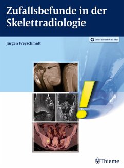 Zufallsbefunde in der Skelettradiologie (eBook, ePUB) - Freyschmidt, Jürgen