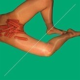 Rub Remixed Rub Remixed