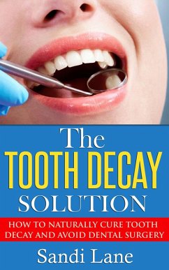 The Tooth Decay Solution (eBook, ePUB) - Lane, Sandi