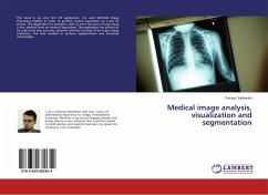Medical image analysis, visualization and segmentation - Sadowski, Tomasz