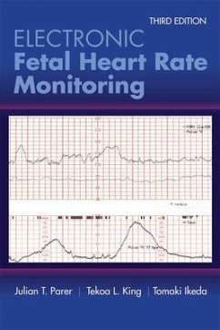 Electronic Fetal Heart Rate Monitoring: The 5-Tier System - Parer, Julian T; King, Tekoa L; Ikeda, Tomoaki