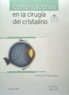 Complicaciones en la cirugía del cristalino - Poyales Galán, Francisco; Garzón Jiménez, Nuria