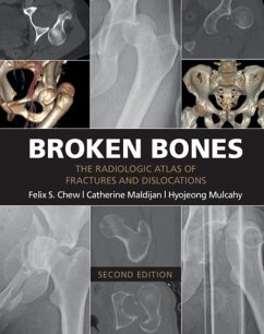 Cover Broken Bones (eBook, PDF)